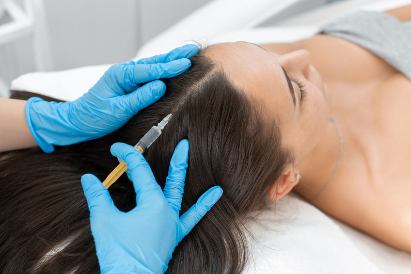 PRP injection into the hair.