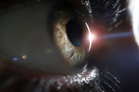 Retina of one eye