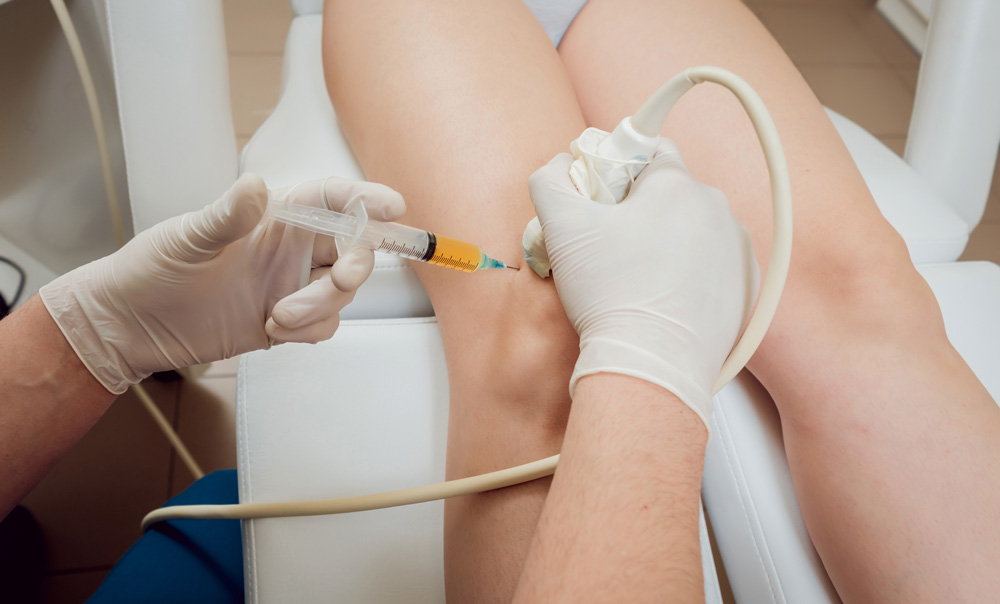 PRP procedure in the knee operation.