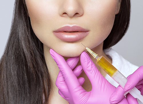 PRP method for lips, aesthetic use.