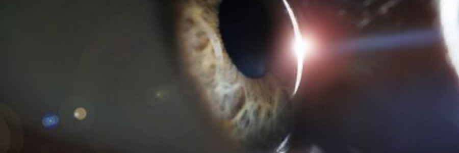 Manejo de la isquemia profunda de la capa capilar retiniana