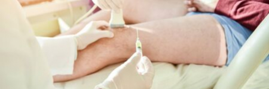 Inyecciones de PRP guiadas por ecografía para degeneraciones meniscales intrasustanciales