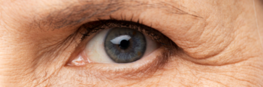 Manejo de la Retinosis Pigmentaria