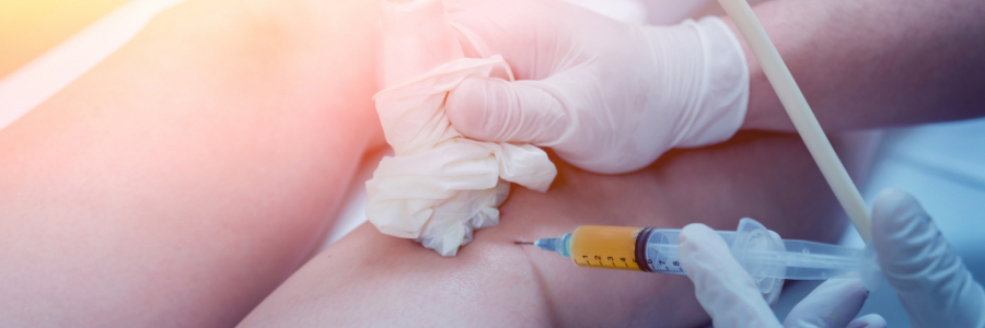 PRP y patologías de rodilla: indicaciones y protocolo de inyección