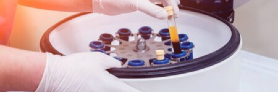 Plasma rico en plaquetas (PRP) - definicion, protocolo y aplicaciones
