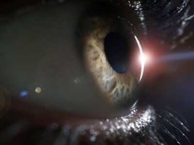 Manejo de la isquemia profunda de la capa capilar retiniana